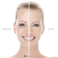 VON BARONESS Anti-Aging Face Cream - with White Caviar Extract, Retinol, Collagen, and Hyaluronic Acid - Reduce Wrinkles and Fine Lines, Deeply Hydrate, and Enhance Radiance