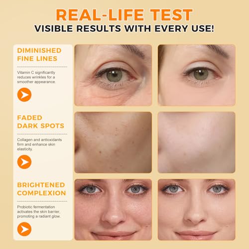 2PC Vitamin C Serum for Face Korean 20% Vit C Serum for Dark Spots, Wrinkles & Fine Lines Anti Aging, Hyaluronic Acid Powerful Collagen Boosting & Skin Brightening Facial Serum Skin Care Women/Men