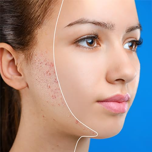 silicol Silicolskin - For spots, blackheads, and oily skin - A clinically tested solution - 50ml