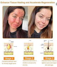 FHRKZZ 7Day Multi-Effect Al-in-One Skincare Cream, Powerful All-Body Skin Cream,MoisturizeProfessional Bee Venom Cream Repair,,Bee Venom Body & Face Cream for All Skin Types