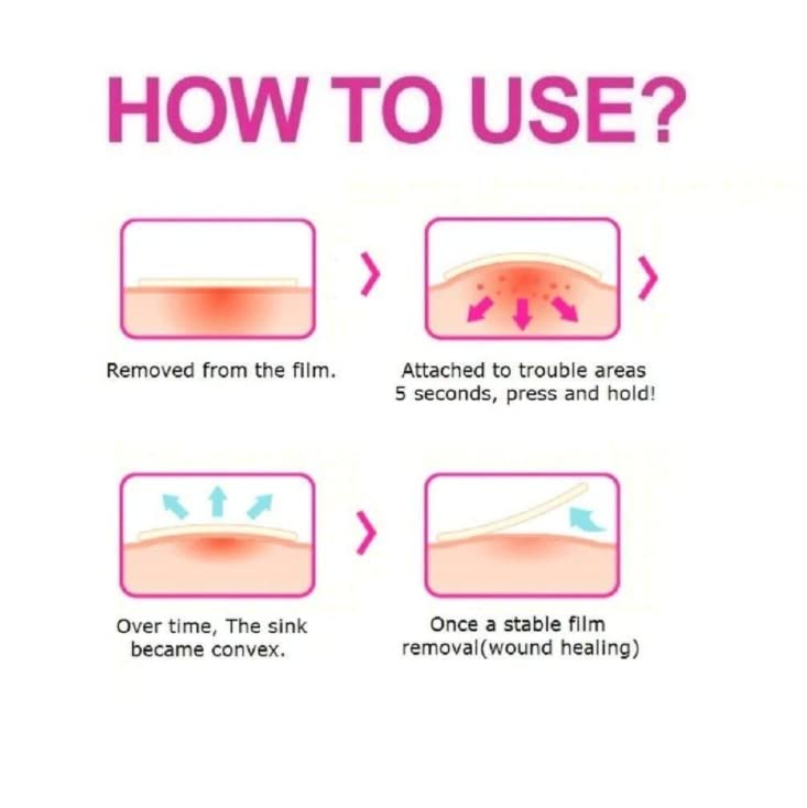 ZEESOON Acne Cover Spot Patch for Olive Young Care Plus Spot Patch (102ea) Acne Spot Pimple Absorbing Cover Patch, Moist Wound Dressing for Skin Trouble Acne Pimple Care Hydrocolloid Patch (102ea x 2packs)