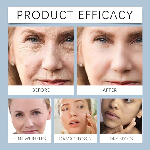 IZBEAUVO Serum For Face/Neck/Eyes with Hyaluronic Acid,Retinol Face Serum,Retinol Face Moisturiser,Anti Aging Serum For Face Moisturizing, Fine Line, Skin Repair,Women & Men