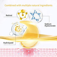 60 (30 pairs) Lanbena Retinol Hyaluronic Acid Collagen Hydra-Gel Eye Pads/Patches – Reduce Fine Lines and Wrinkles Dark Eyes, Eye Bags, Black Bags, Crows Feet, Smoother Fresher Looking Eyes and Skin