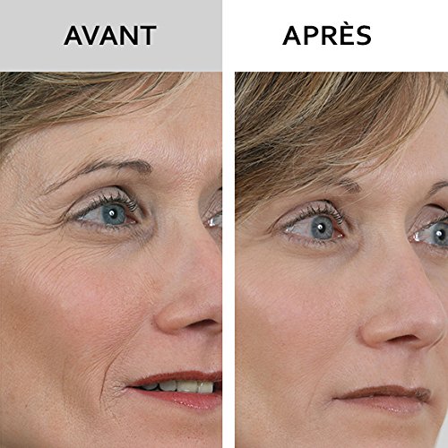 SKINEANCE - WRINKLE FILLER WRINKLE FILLER - Smoothes, fills and smoothes fine lines and wrinkles - Precise, instant and long-lasting results - Proven effectiveness - set of 3 tubes of 15 ml