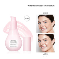 Watermelon Glow Niacinamide Dew Drops Highlighting Serum, Glow Recipe Watermelon Hydrating Serum With Hyaluronic Acid, Brighten, Moisturizing, Lightweight Facial Serum & Priming Liquid Highlighter