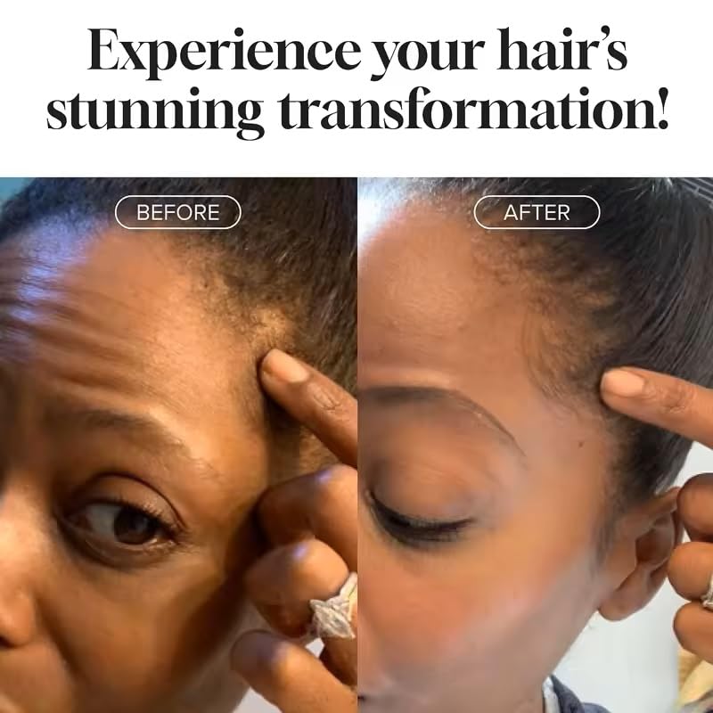 APS Livingstone Hair Growth & Anti-hair fall Shampoo with Caffiene, Biotin, and Argan Oil- Silicon & Paraban Free-Treatment for Women's and Men's Advanced Hair Thinning-Purely Vegan