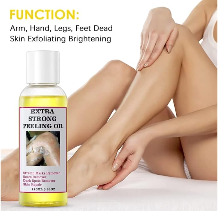 DMQ Yellow Peeling Oil - Lightening Exfoliating Dark Skin For Body, Strong Peeling Oil, Skin Peeling Oil For Skin Lightening, Peeling Oil For Skin Brightening Moisturizing, Peeling Solution Dark Skin