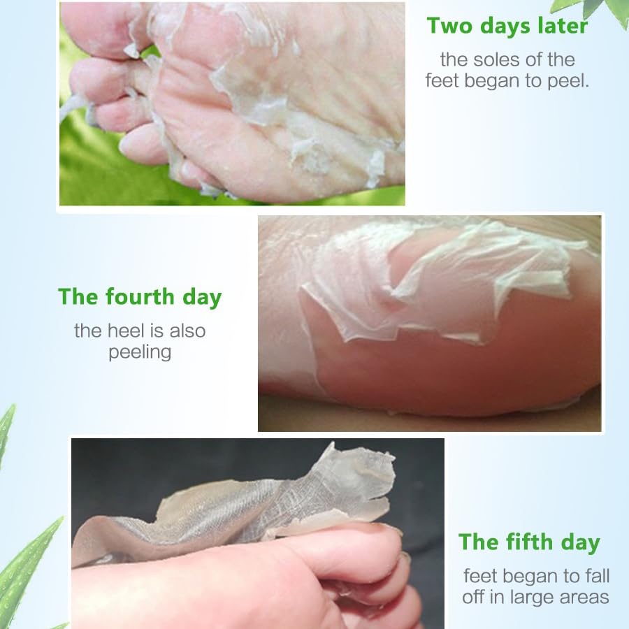 Foot Peel Mask,4 Pairs Natural Aloe Vera Gel Foot Mask-Foot Peel Mask For Hard Skin,Footner Exfoliating Sock-Feet Hard Skin Remover-Plantifique Foot Peel Mask-Baby Feet Foot Peel (Aloe Vera)