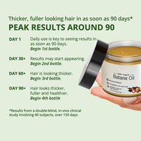 Skynest Raw Batana Oil for Hair Growth: 100% Pure - Dr. Sebi Batana Oil from Honduras Unrefined Promotes Hair thickness for Men & Women 4.23 OZ