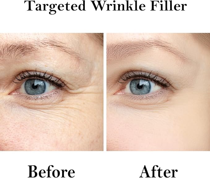 Generic Wrinkle Filler that Works with Hyaluronic Acid - Instantly Smoothens Skin, Clinically Proven Results | Cruelty Free, Vegan & Dermatologically Approved (15ml)