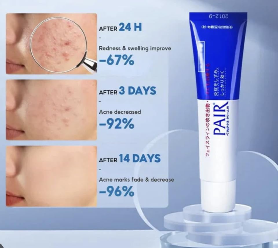 Acne Treatment Cream, Anti-Inflammatory Formula, Transparent Application, 67% Reduction in 24h