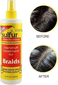 Generic Sulfur Medicated Anti-Dandruff Conditioner for Braids, 356 ml