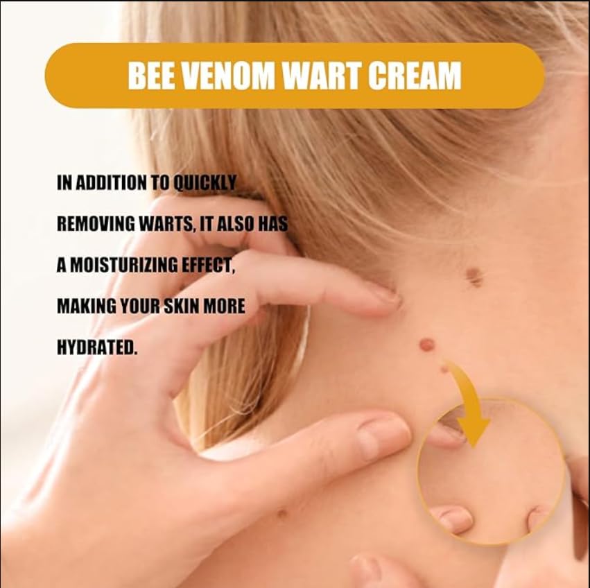 Generic Wree Bee Venom Wart and Tag Remover,Wree Bee Venom Wart and Tag Remover Cream,Wree Bee Venom (1)