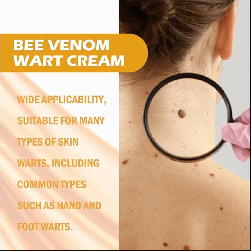Generic Wree Bee Venom Wart and Tag Remover,Wree Bee Venom Wart and Tag Remover Cream,Wree Bee Venom (1)