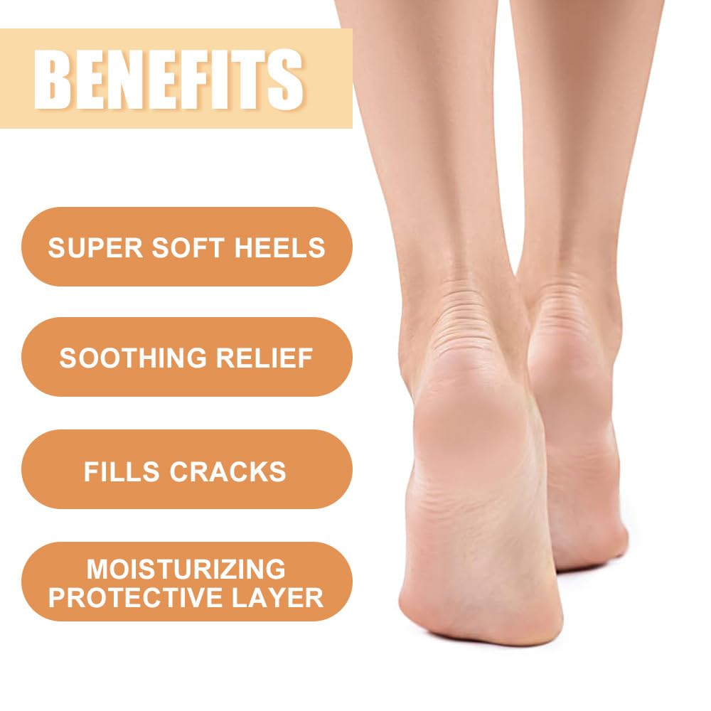 Honey Foot Cream for Very Dry Feet & Cracked Heels - Intensive Moisturising Repair Cream for Cracked Skin, Hard Skin Remover - Natural Foot Care Moisturiser for Women & Men