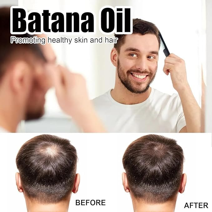 Generic Batana Oil Organic for Healthy Hair,Batana Oil Premium 100% Natural,Promotes Hair Wellness for Men & Women Enhances Hair & Skin Radiance(2pcs)