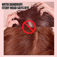Generic Sulfur Medicated Anti-Dandruff Conditioner for Braids, 356 ml