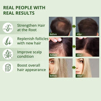 Skynest Raw Batana Oil for Hair Growth: 100% Pure - Dr. Sebi Batana Oil from Honduras Unrefined Promotes Hair thickness for Men & Women 4.23 OZ