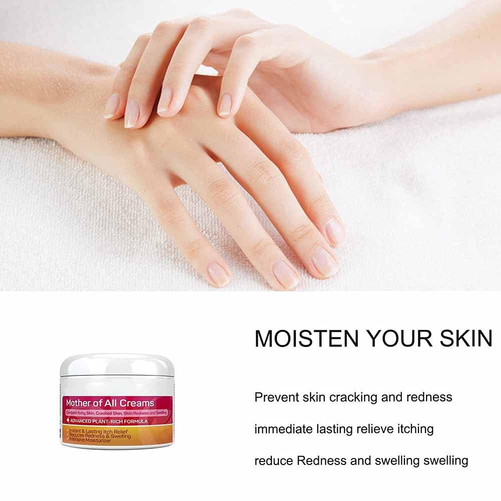Allbestaye Skin Psoriasis Cream Dermatitis And Eczema Eczema Ointment Treat Dry, Itchy And Sensitive Skin, Face And Body Care Skin Redness And Rash