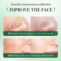 ZQUKAMZ Wormwood Mud Clay Mask - Deep Cleansing Pore Purifying Clay Mask with Tea Tree, Bentonite and Kaolin Clay - Vegan Clay Mask for Face and Body 40g