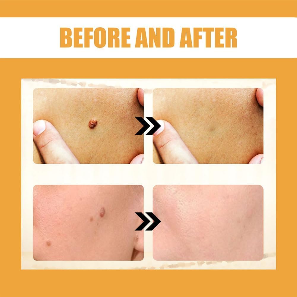 ALLILUYAA 2PCS LIPOGO Bee Venom Cream, Lipogo Professional Bee Venom Cream Gel for All Skin Types