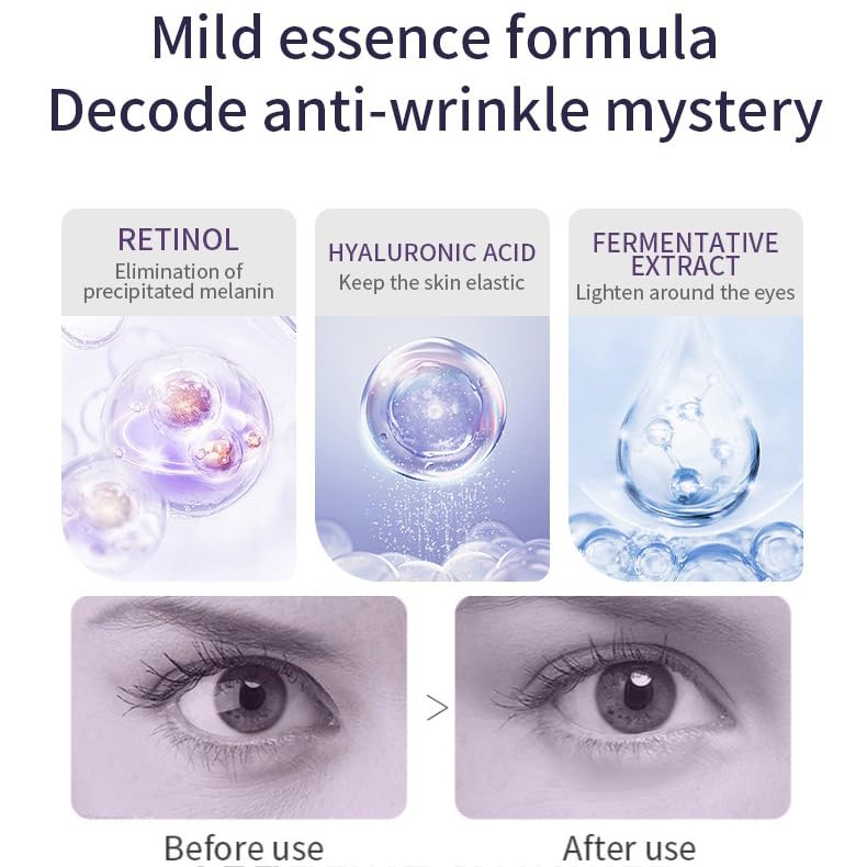 Retinol Eye Cream-Eye Cream For Dark Circles And Puffy Eyes,Anti-Aging Eye Cream With Retinol Serum,Hyaluronic Acid,Retinol Serum-Anti Wrinkle Eye Cream-Moisturising Eye Bags Remover