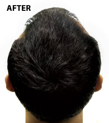 Super Million Hair - 1 x 40g Hair Building Fibres - No.6 Light Blonde by From the UK - Order by 1pm for next working day