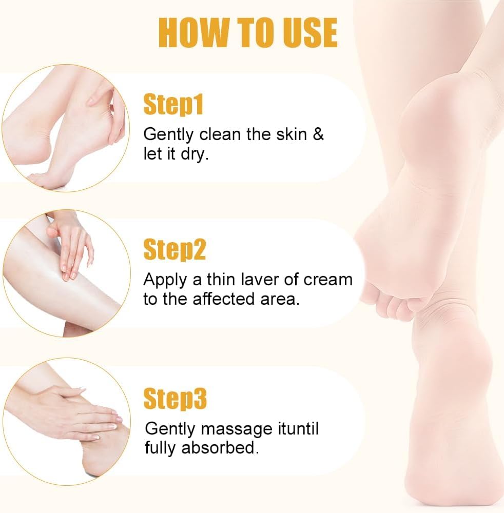 KoolShiro Urea Cream 60% for Feet, 2025 New Maximum Strength Foot Cream for Dry Cracked Skin and Feet, Urea Foot Cream, Foot Moisturiser, Repairing Creams for Heels, Knees, Elbows & Hands