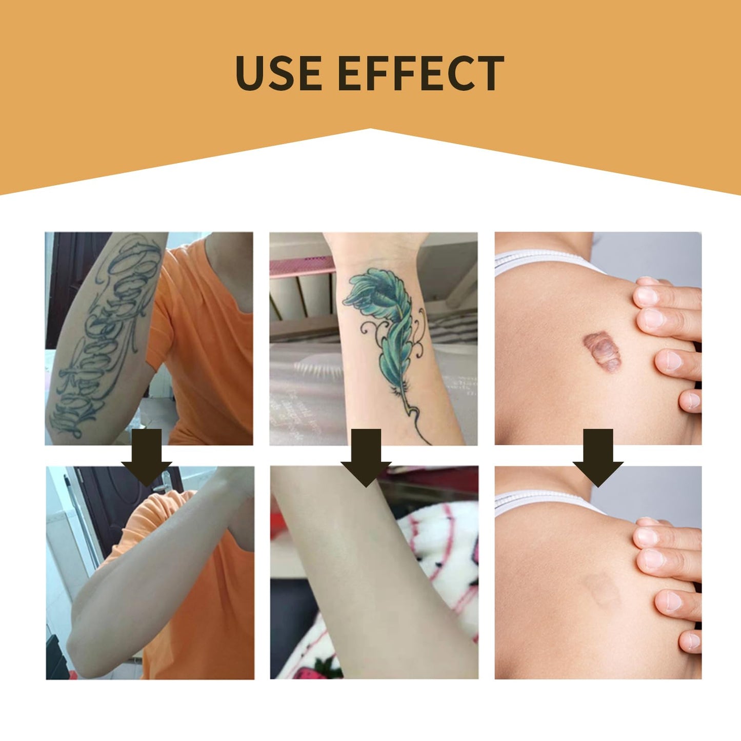 Cynamus Pack of 2 Tattoo Cover Up Stickers, Tattoo Concealing Tape, Scar, Covering Tape, Skin Tone Concealer Stickers, Breathable and Waterproof Skin Concealing Tape for Covering Tattoos