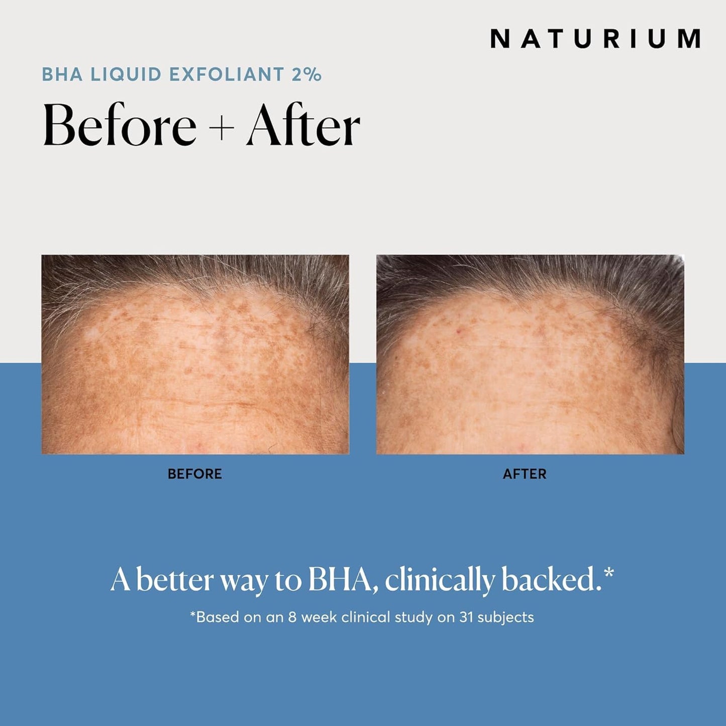 Naturium BHA Liquid Exfoliant 2%, Leave-on Face & Skin Care Pore Exfoliant, with Salicylic Acid & Bioactive Fruit Acids | 4.0 FL OZ / 120 ML