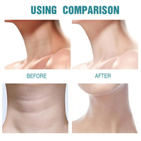 FunnAura Crepe Be Gone Body Souffle, Neck Firming Cream, Skin Tighten and Lift Neck Cream for Anti Wrinkle and Hydration