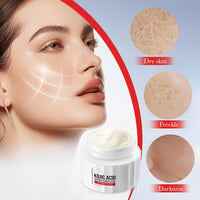 ISBEAUSOLS Kojic Acid Cream - Skin Lightening Cream for Anti Aging - Dark Spot Remover for Face - Hydrating Face Moisturiser for Dry Skin - Face Cream for Women - Anti Wrinkle Face Care, Moisturising,50g
