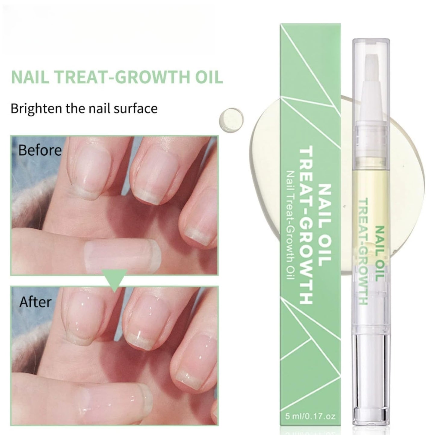 2PCS Radiant Nail Growth Oil,Cuticle Oil for Nail,Cuticle Nail O/il,Radiant Nail Growth Oi/l Pen,Nail Growth O/il,Cuticle Moisturizer & Nail Strengthener,Finger Edge Manicure Nourishing Pen