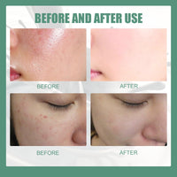 Xunzhi Matcha Hydrating Cleanser,Face Cleanser,Non Stripping Daily Face Wa/sh,Exfoliating Fa/ce W/as/h,Hydrating Gel Cle/anser,F/ace Wa/sh Women,Fac/e Wa/sh for All Skin Types,Facial Clean/ser