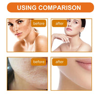 IZBEAUVO Orange Face Exfoliator 2Pcs, Vitamin C Facial Scrub Gel,Deep Exfoliating Face Wash,Blackhead Scrub,Orange Gel Face Scrub Brightening Skin,Soft Your Skin and Remove Dead Skin (2)