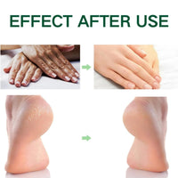 Yoowan Foot Cream For Cracked Heels And Dry Skin,Cracked Heel Repair Cream,Hard Skin Remover Foot C-ream,Dry Feet Treatment,Repairing Cracked Heel And Itchy Feet,Hydrate&Soften,For Heels,Knees,Elbows&Hands