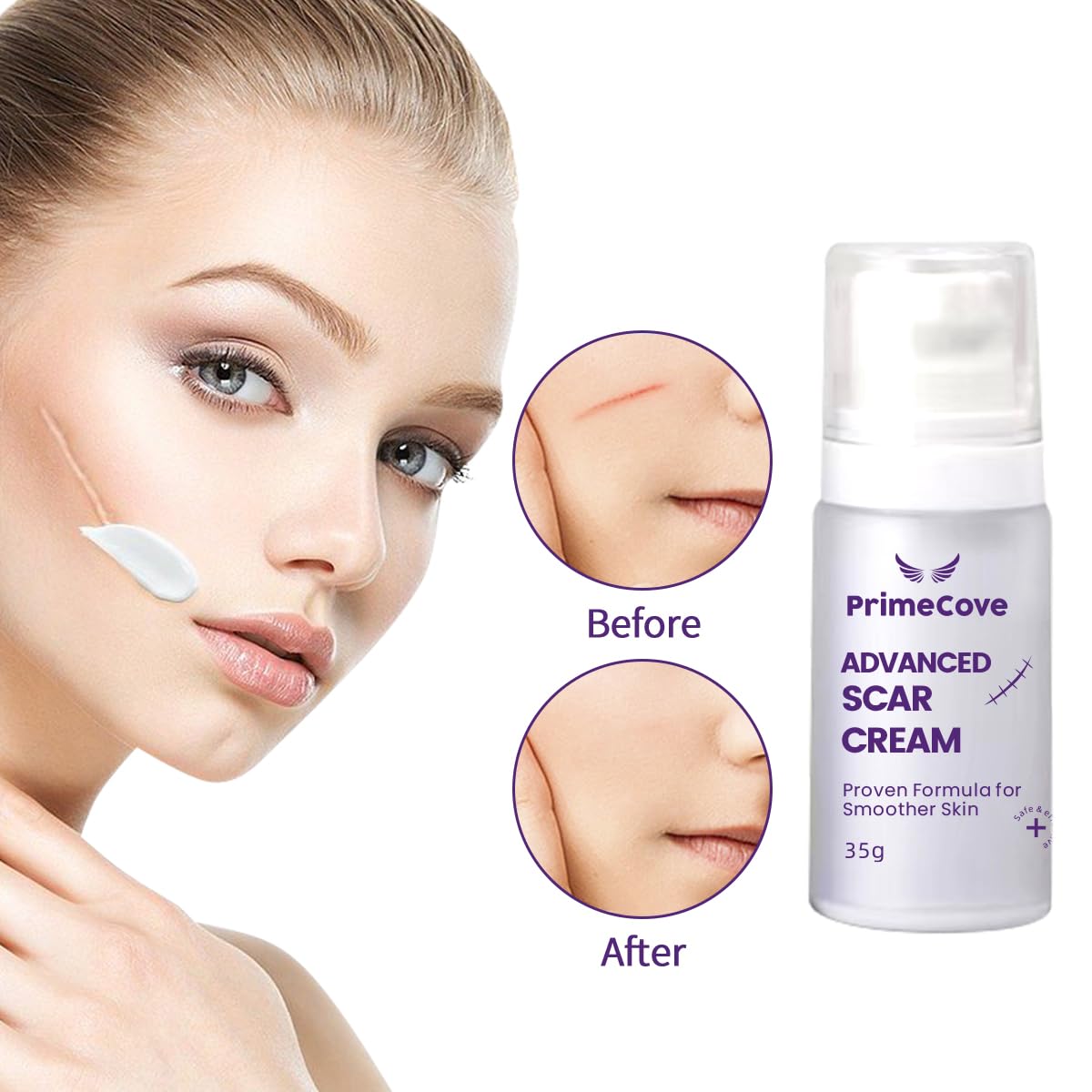 PrimeCove - Advanced Scar Cream (35g) | Remove Surgery, Injury and Acne Scars