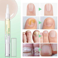 2pcs Radiant Nail Growth Oil,Cuticle Moisturizer & Nail Strengthener with Vitamin E Cuticle N/ail Oi/l,Radiant N/ail Growth O-il Pen,Cuti-cle Oi/l Pen for Nails,Nail-Oil Treatment for Damaged Na-ils