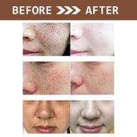 ISBEAUSOLS Glutathione Face Cream 2PCS - Kojic Acid Face Cream for Skin Tone Correcting - Vitamin C Face Cream - Face Moisturiser Cream - Skin Care Face Cream - Anti Wrinkle, Anti Aging