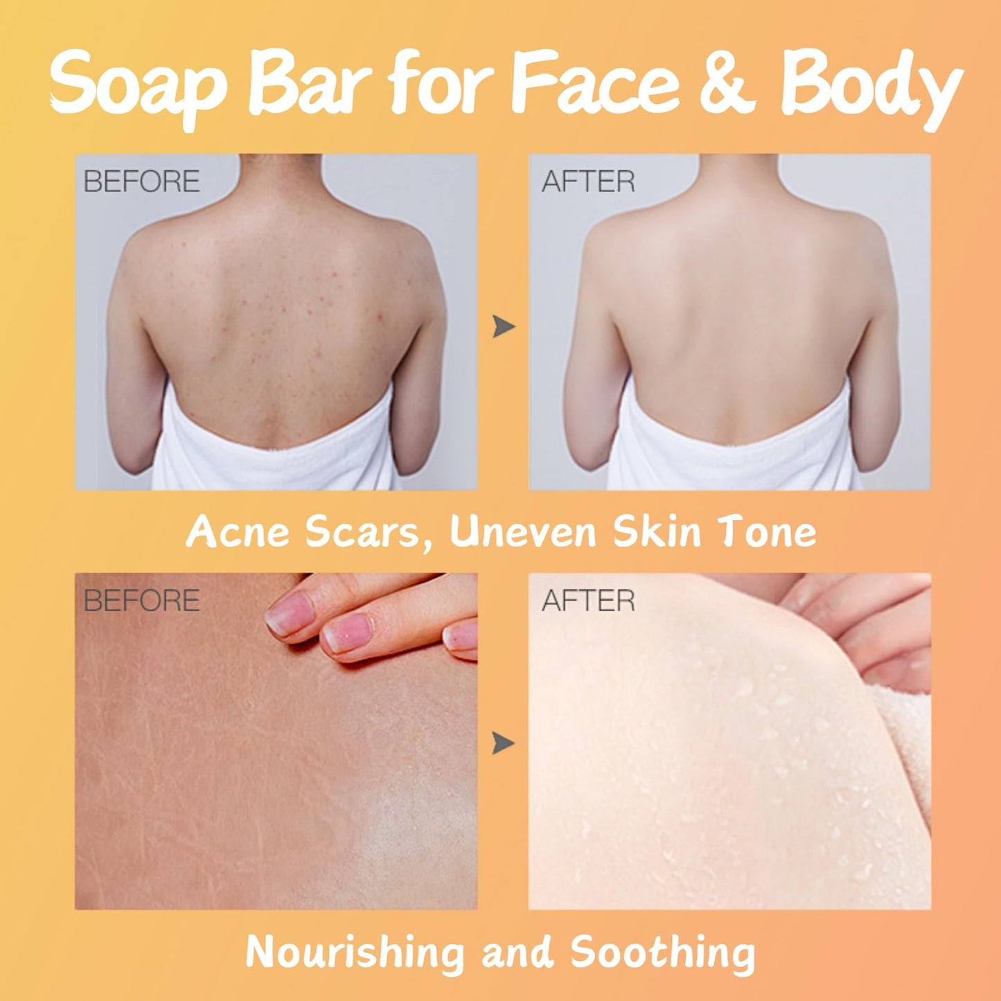 Kojic Acid & Papaya Skin Brightening Soap - Soap Bar for Face & Body Smooth - Acne Scars, Uneven Skin Tone - Dark Spot Correcting Soap - Solid Soap Bars for Hyperpigmentation (2 PCS)