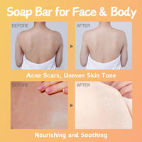 Kojic Acid & Papaya Skin Brightening Soap - Soap Bar for Face & Body Smooth - Acne Scars, Uneven Skin Tone - Dark Spot Correcting Soap - Solid Soap Bars for Hyperpigmentation (2 PCS)