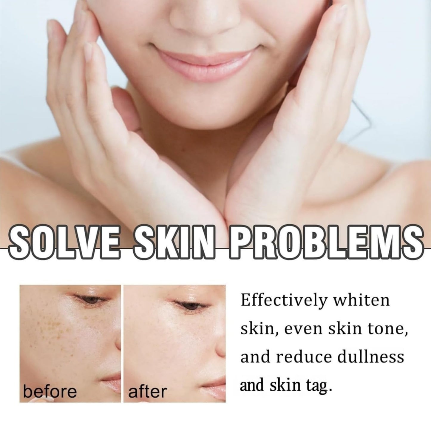 Yoowan Rapid Skin Repair Cream,Skin Ta/g Remover,Anti Wrinkle Face Cream,Sk-In Lightening Cre-Am,Blemish Cre-Am,Intense Hydration,Redness Relief Moisturizer,Comprehensive Bee Ven-Om Balm For Dry,Sensitive