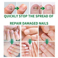 Ginger Nail Essence, 7days Nail Treatment,Hand Oil Damaged Nail Repair And Strengthening Nail Care 3PCS
