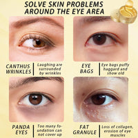 24 Gold Under Eye Masks, Gold Collagen Eye Masks for Puffy Eyes, Under Eye Gel Patches for Dark Circles, Anti Wrinkle, Skincare, Look Younger and Less Tired, Moisturize Your Skin