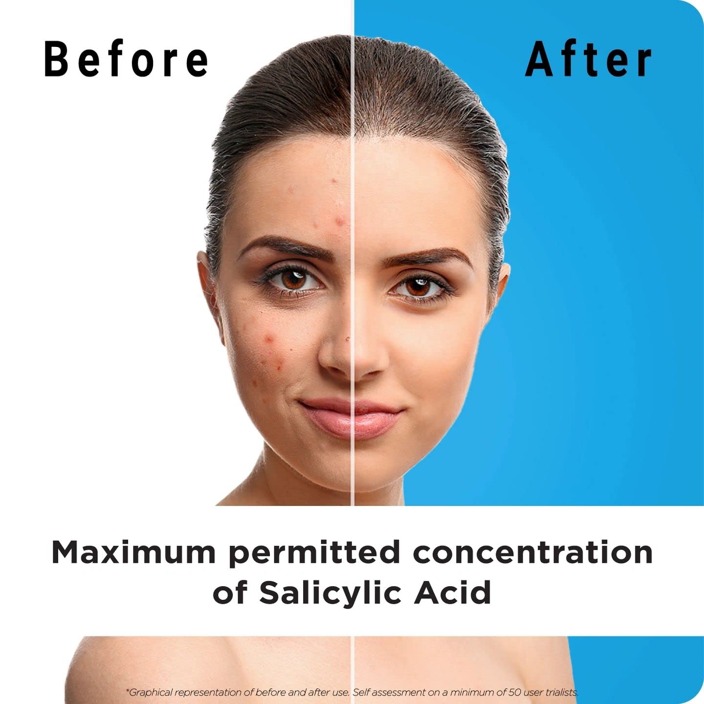 Generic Exfoliating Face Wash with Salicylic Acid (Pack of 3) - Visible Results from Day 1 | Purifies & Unclogs Pores, Reduces Oil & Shine | Cruelty Free & Dermatologically Approved