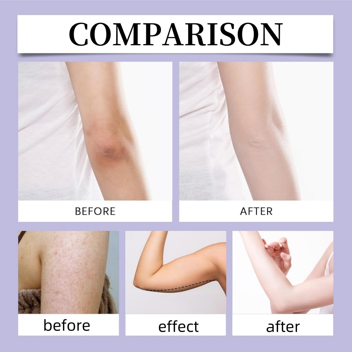 Sculpt And Tone Arm Cream,Firming Body Cream,Firming Cre-Am For Loose Skin,Upper Arm Fir-Ming Cre-Am,Tighting Balm For Loose Skin,Smooth,Deep Moisturizing And Hydrating,Suitable For Sensitive