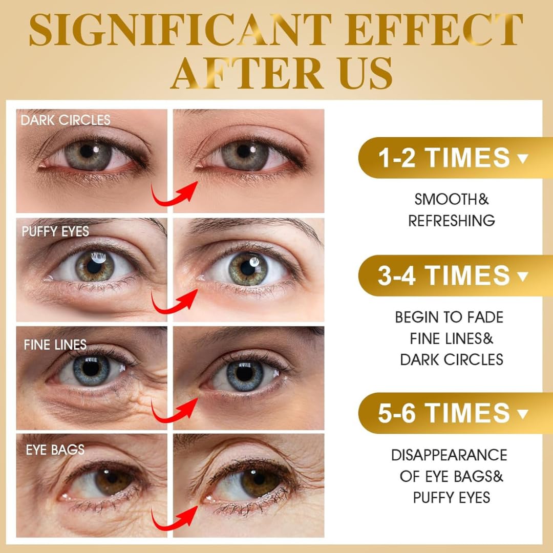 OVALA 24k Gold Under Eye Patches - 60 Pcs Eye Mask Pure Gold Anti-Aging Collagen Hyaluronic Acid Under Eye Mask for Removing Dark Circles, Puffiness & Wrinkles Refresh Your Skin