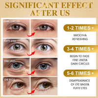 OVALA 24k Gold Under Eye Patches - 60 Pcs Eye Mask Pure Gold Anti-Aging Collagen Hyaluronic Acid Under Eye Mask for Removing Dark Circles, Puffiness & Wrinkles Refresh Your Skin