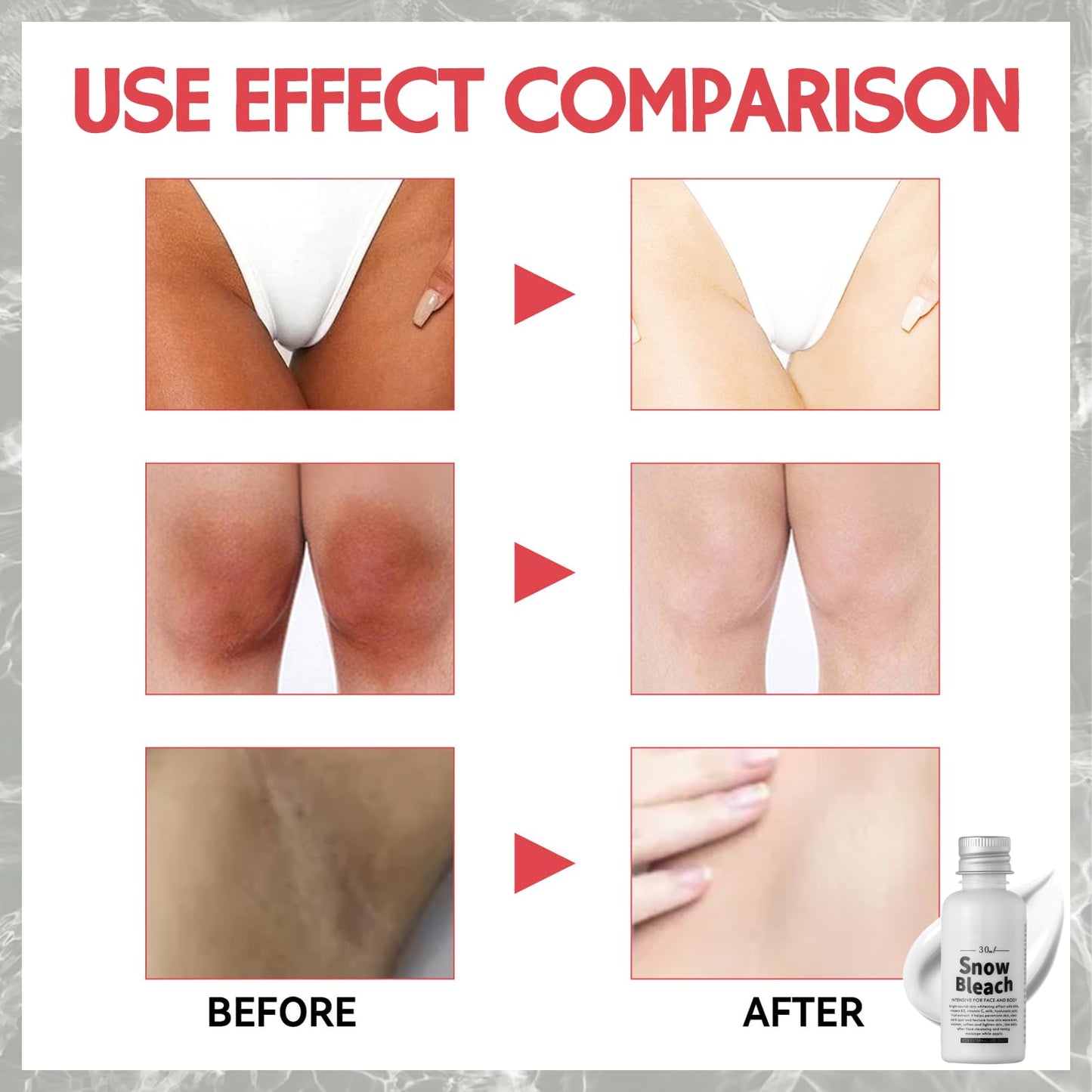 MINSHZEE Skin Bleaching Cream - Feminine Body Care - Underarm Whit/ening Creams - Inner Thigh Body Brightening Creams