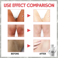 MINSHZEE Skin Bleaching Cream - Feminine Body Care - Underarm Whit/ening Creams - Inner Thigh Body Brightening Creams